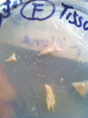 King oyster tissue sample, (clone) from local vege shop.